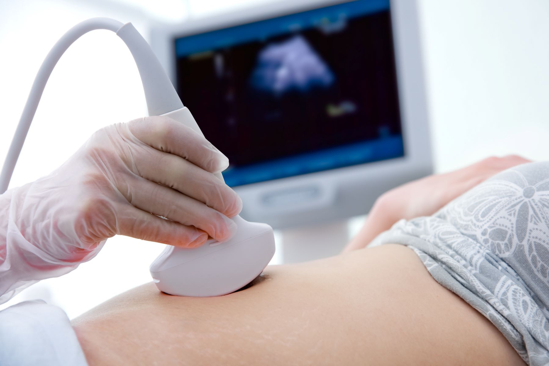 Exames de ultrassonografia. Centro de Diagnóstico. Check Up Hospital.