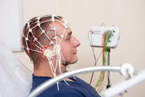 Eletroencefalograma (EEG), exame importante para saúde cerebral. Imagem ilustrativa. Check Up Hospital.